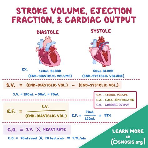 ejection fraction vs stroke volume.